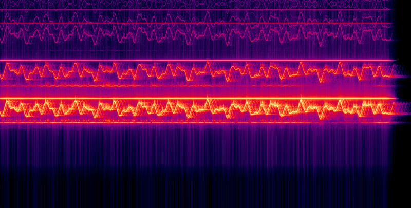 Tinnitus Tone